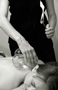 Cupping Therapy at Body Wise Therapy in Leeds